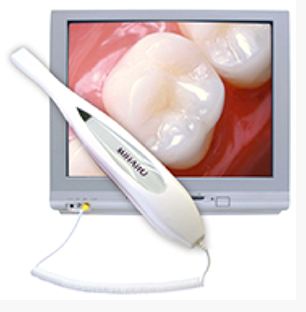 Intraoral cameras are offered by Grins & Giggles Family Dentistry in Spokane Valley, WA